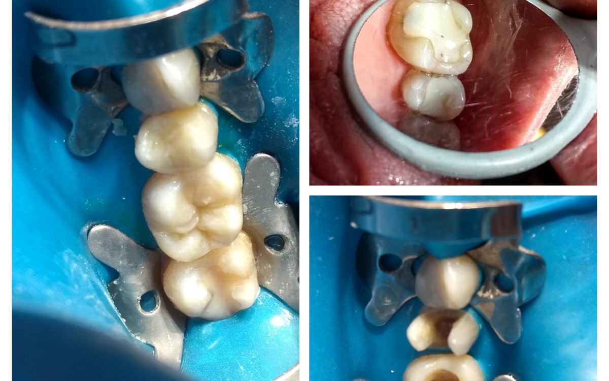 IMG_20181025_115401360-COLLAGE