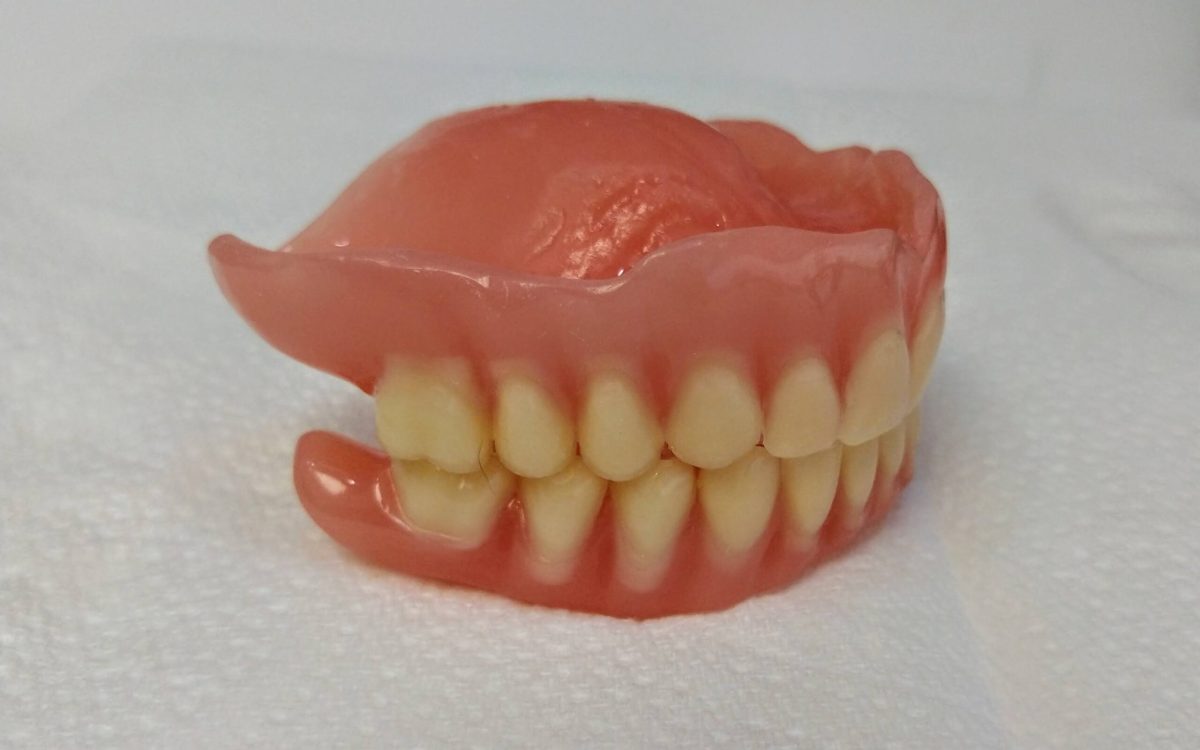 Kivehető pótlás