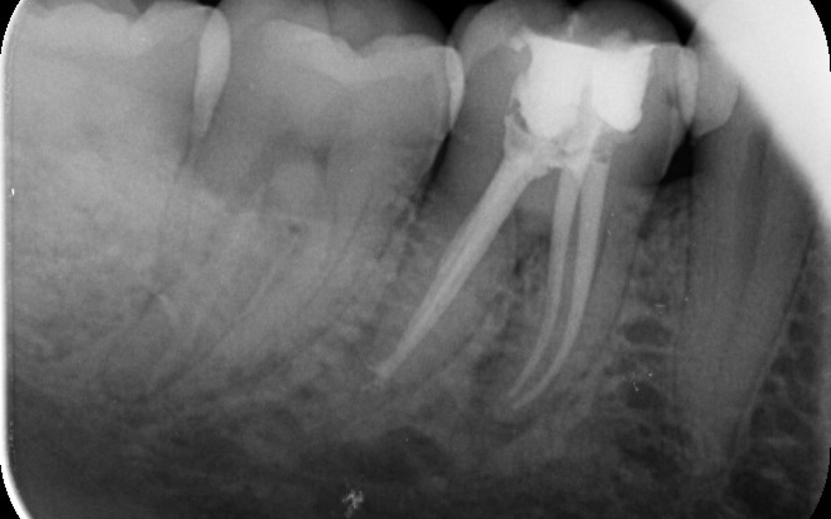Tarsoly_Gábor_11062018_211311